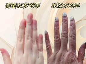 撕手机摄像头胶时如何保护手部？有哪些安全措施？