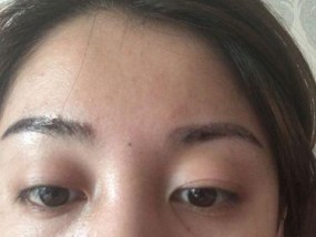 手机拍照出现细纹怎么办？如何提高清晰度？