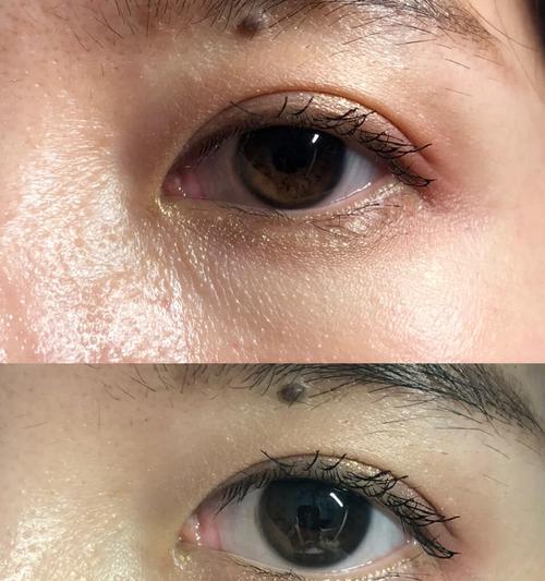 手机拍照出现细纹怎么办？如何提高清晰度？  第2张