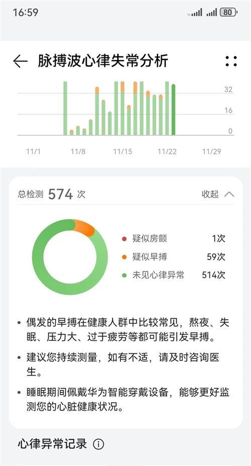 智能手表如何检测心脏早搏？检测准确性如何？  第2张